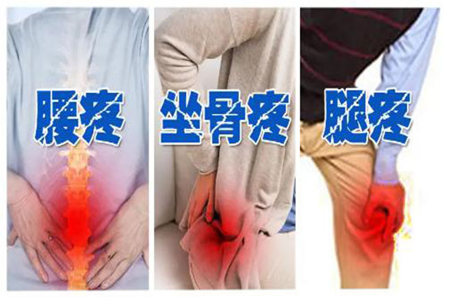 腰椎間盤突出坐姿、睡姿、日常鍛煉、最好治療方法